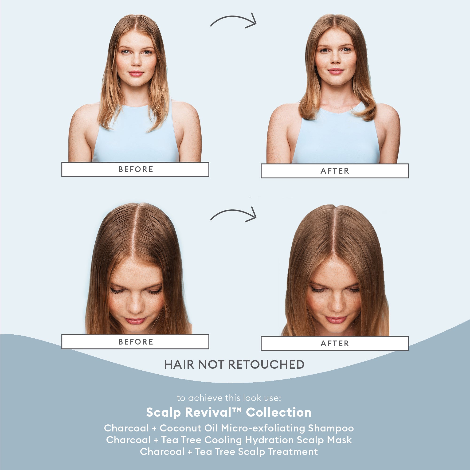 Scalp Soothing Solutions Set