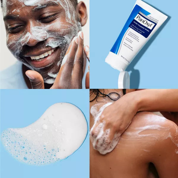Panoxyl Acne Foaming Wash