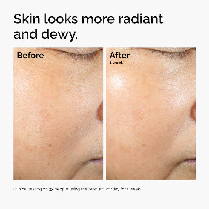 Rice Lipids + Ectoin Microemulsion Moisturizer for Soothing Hydration & Reduced Redness