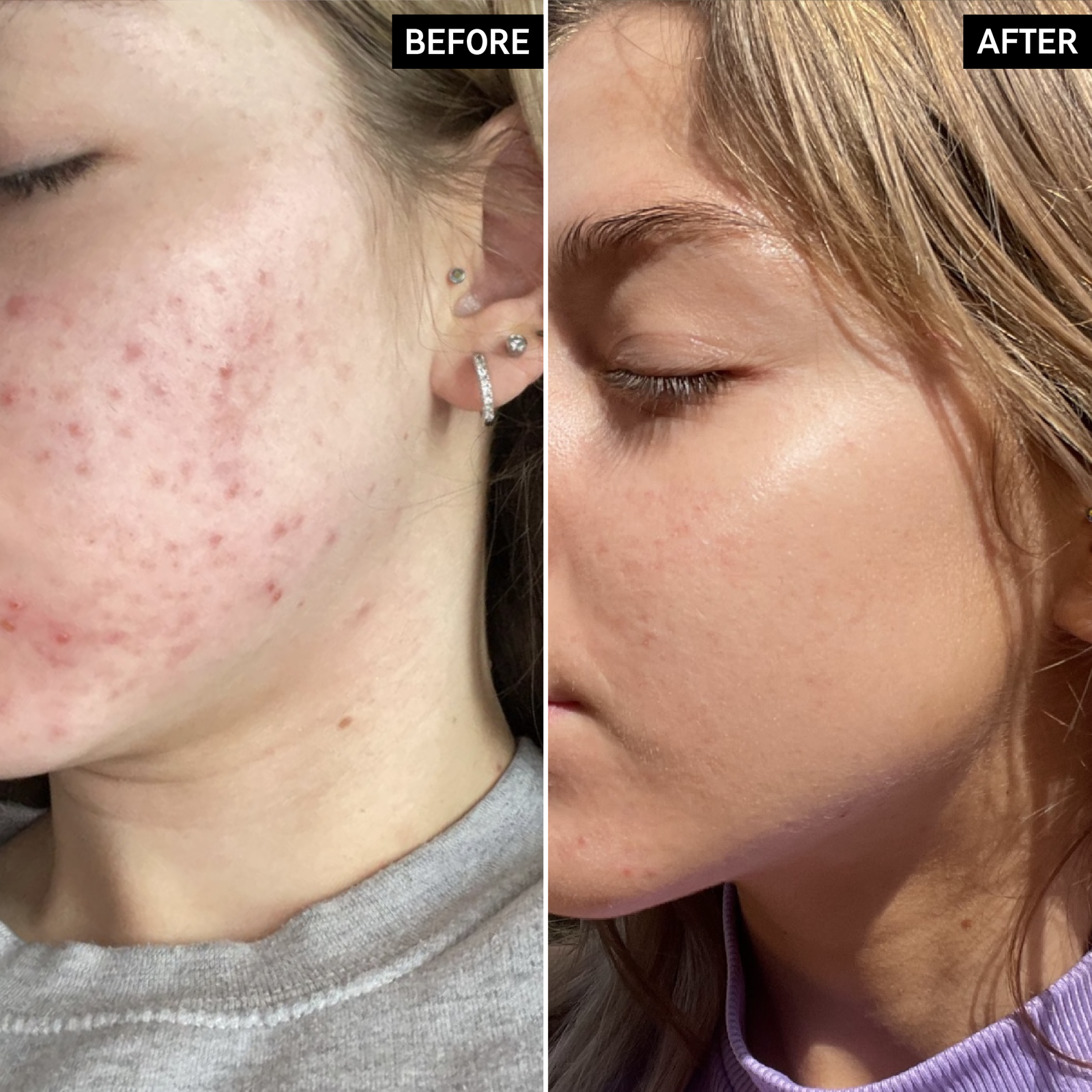 Niacinamide Oil Control Serum