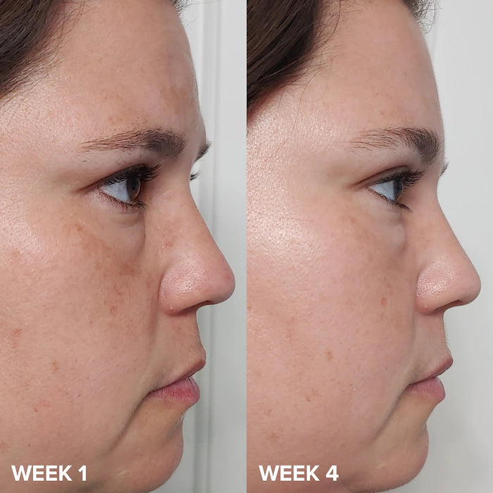 Skin Perfecting 2% BHA Exfoliating Toner