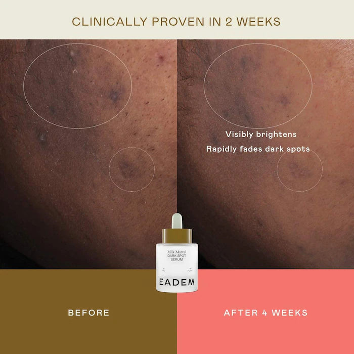 Milk Marvel Dark Spot Serum with Niacinamide and Vitamin C