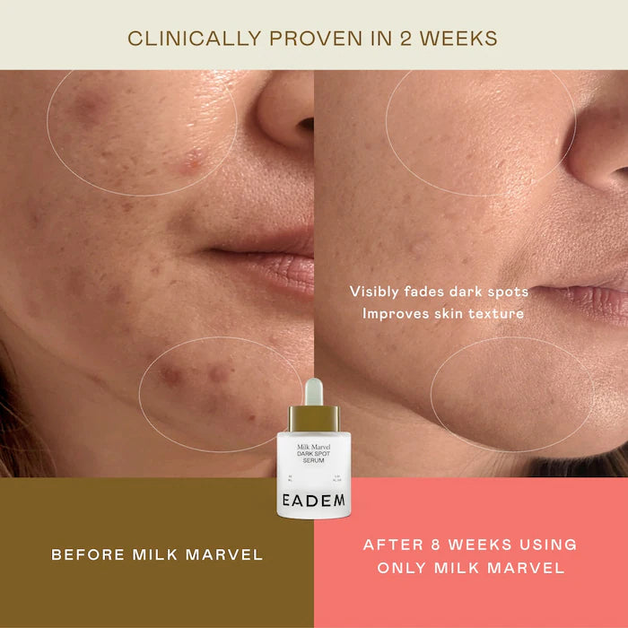Milk Marvel Dark Spot Serum with Niacinamide and Vitamin C