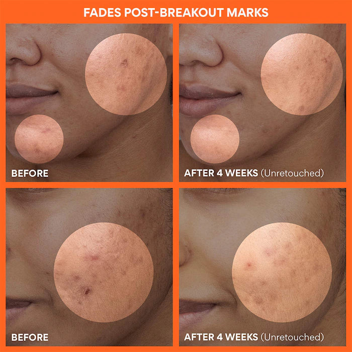 Daily Vitamin C Korean Brightening Toner Pads with Niacinamide for Dark Spots