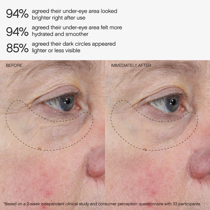 Faded Under Eye Brightening & Clearing Eye Masks