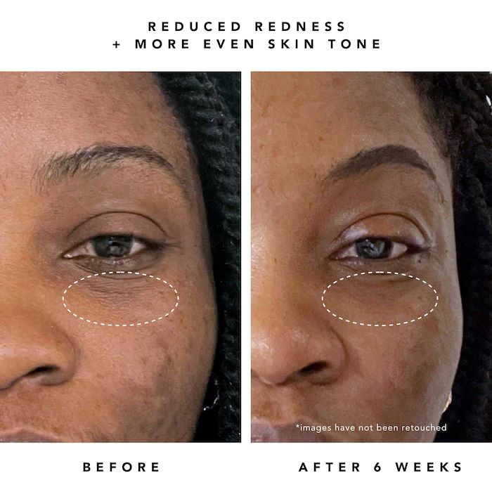 Moon Fruit 1% Bakuchiol + Peptides Retinol Alternative Serum