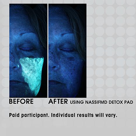 Nassif MD Detox Pads - Beauty Box Mérida