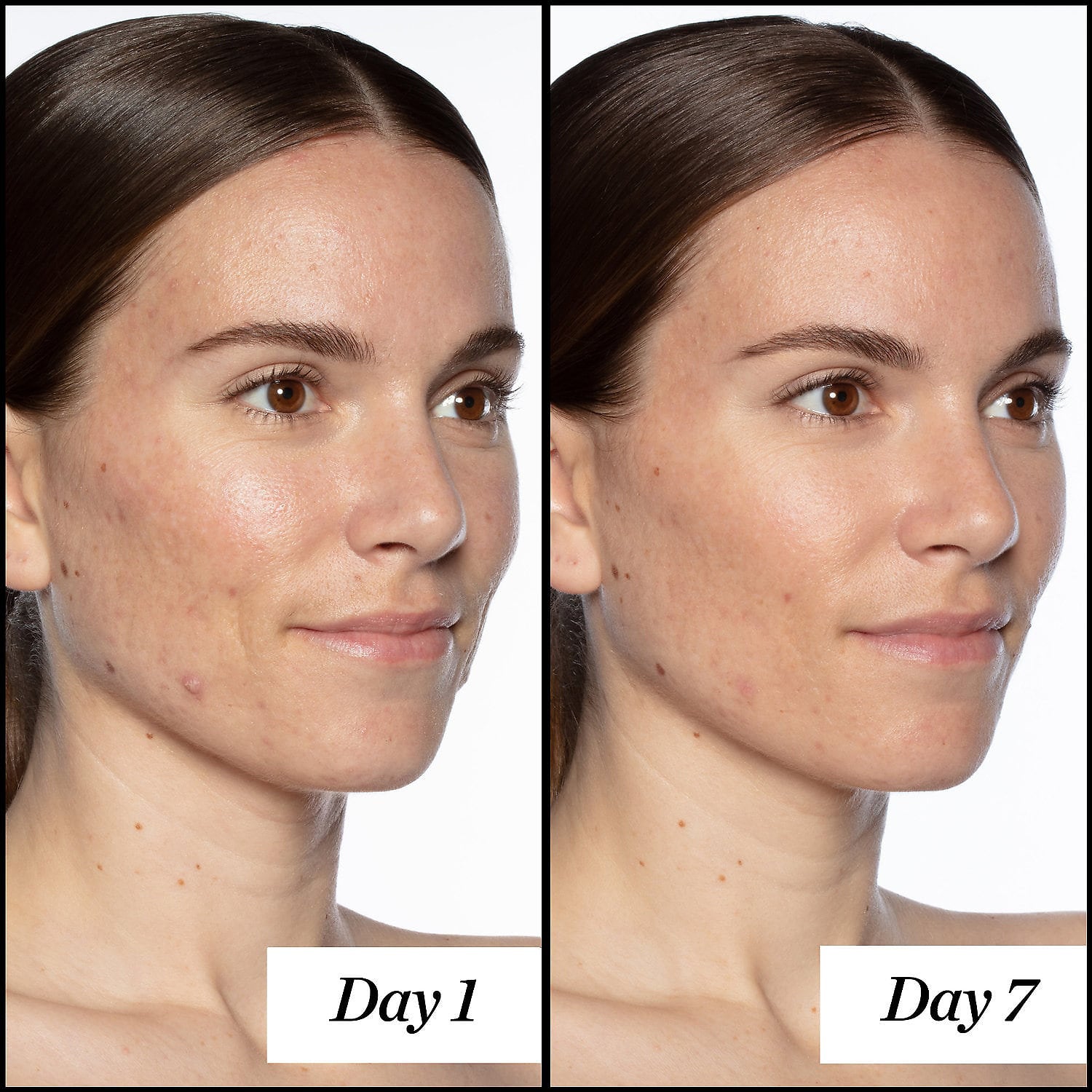 Good Genes All-In-One Lactic Acid Treatment - Beauty Box Mérida