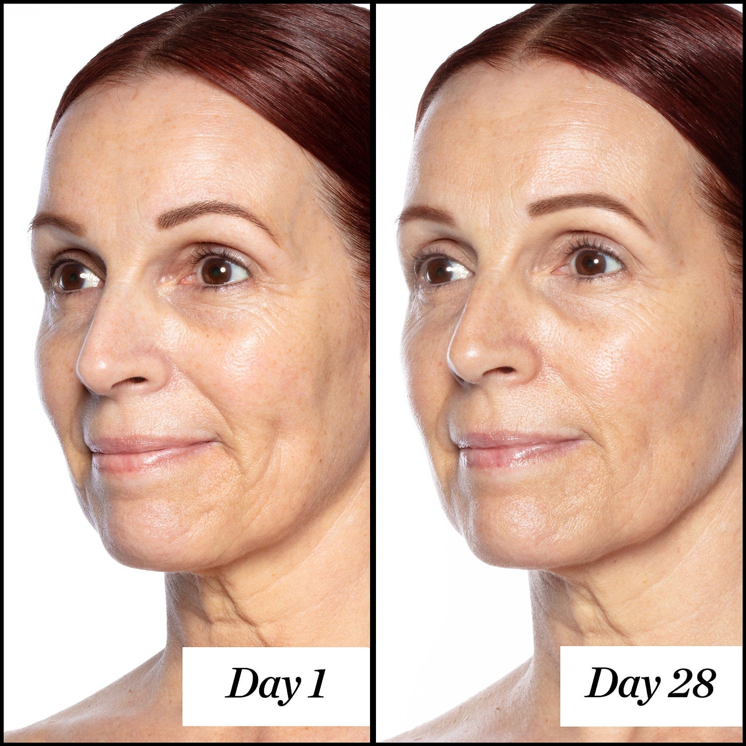 Good Genes All-In-One Lactic Acid Treatment - Beauty Box Mérida