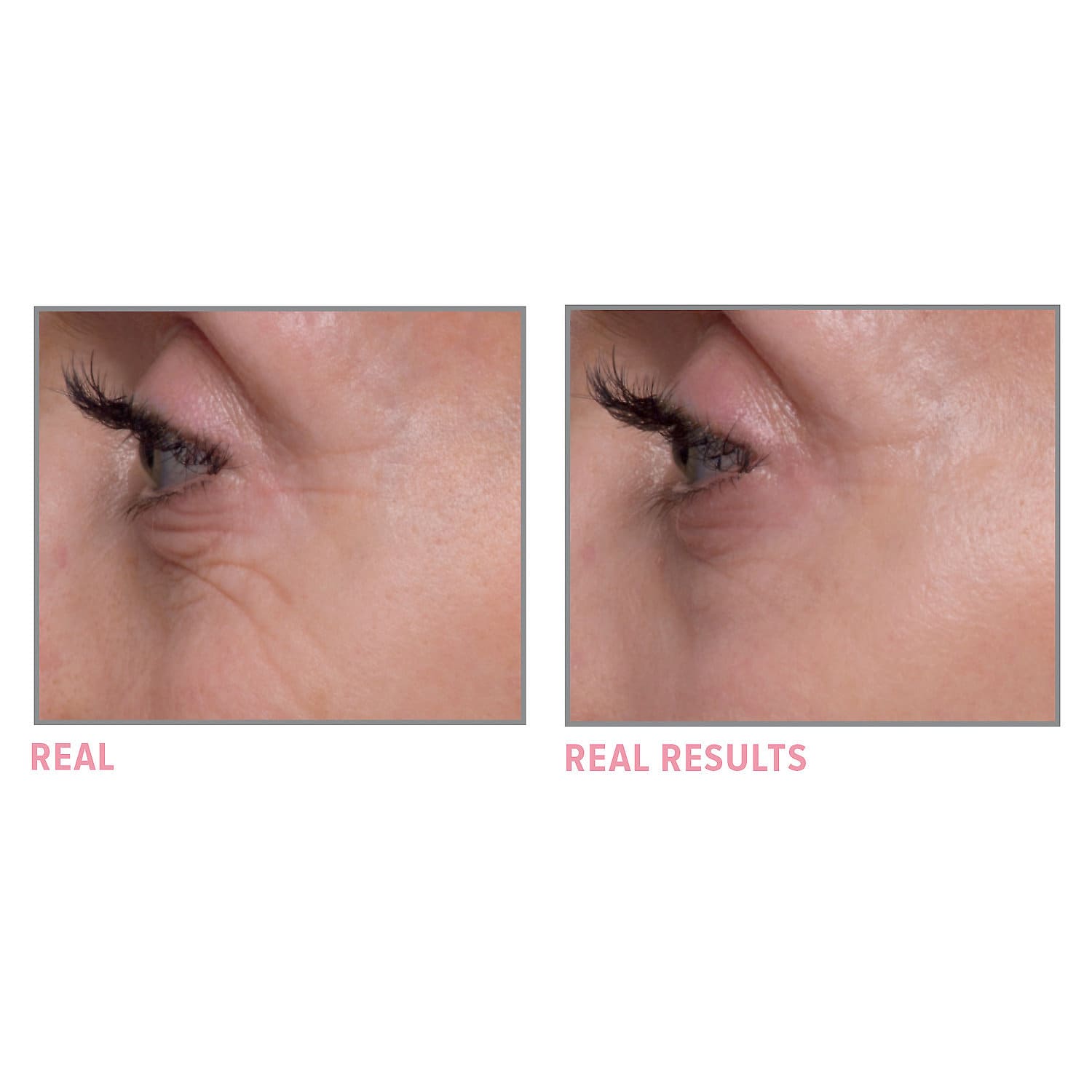 Bye Bye Under Eye Brightening Eye Cream - Beauty Box Mérida