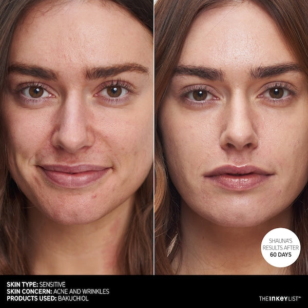 Bakuchiol Retinol Alternative Moisturizer