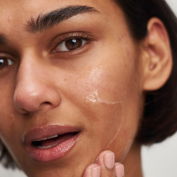Tranexamic Acid Hyperpigmentation Treatment