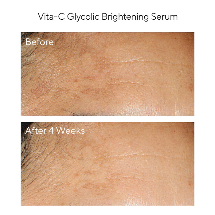 Brighten Trial Kit