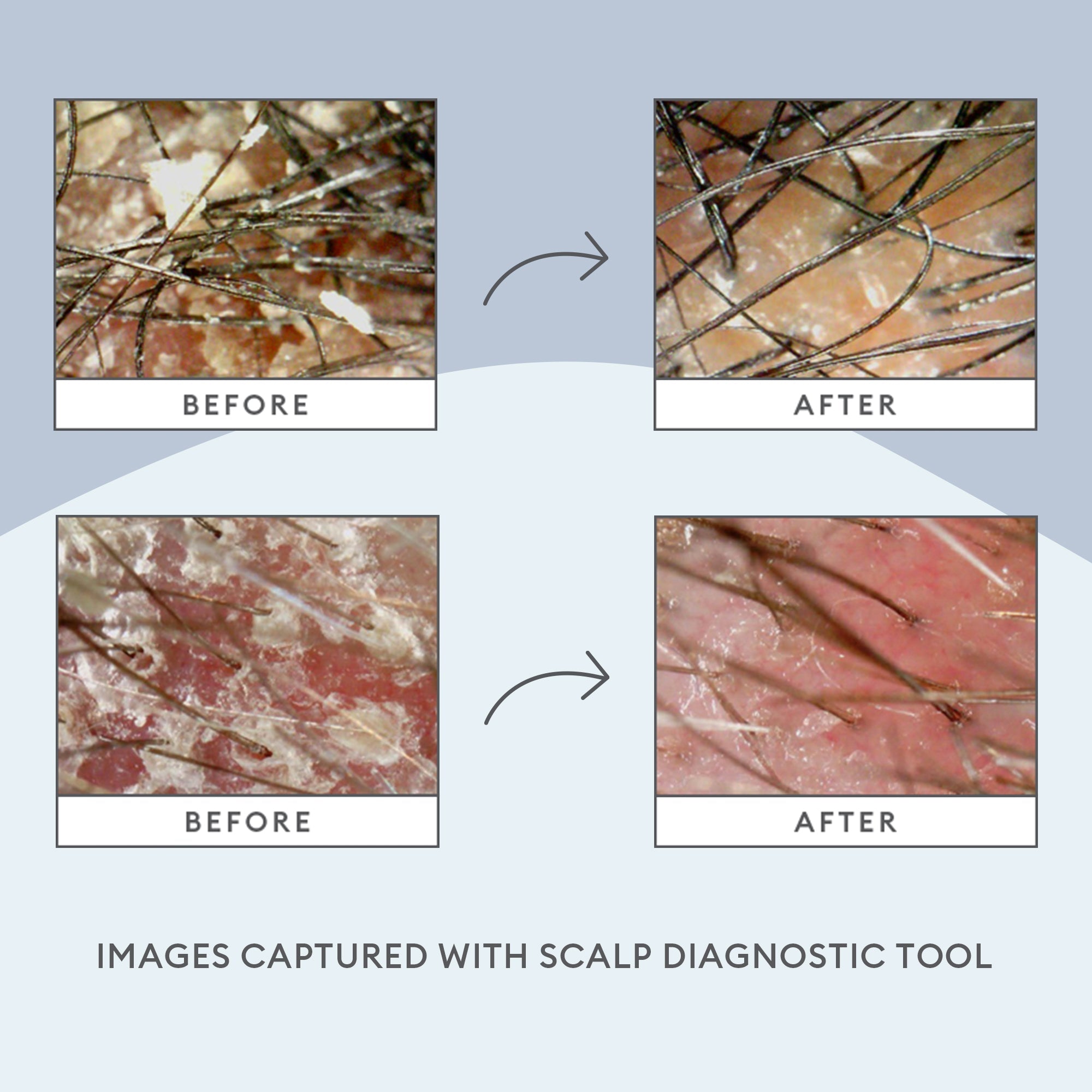 Scalp Soothing Solutions Set