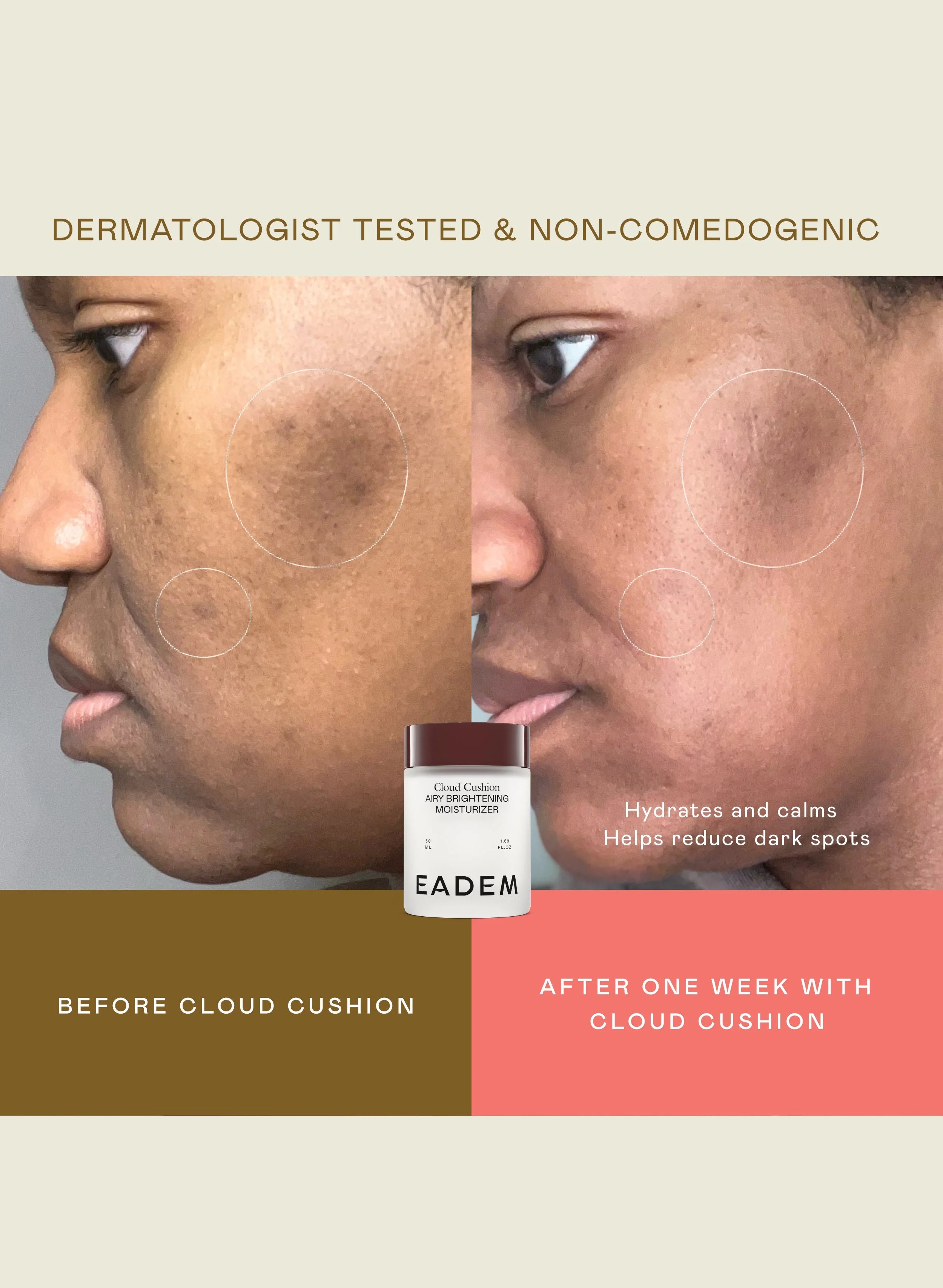 Aplicación de EADEM Cashmere Peel tratamiento para manchas y poros