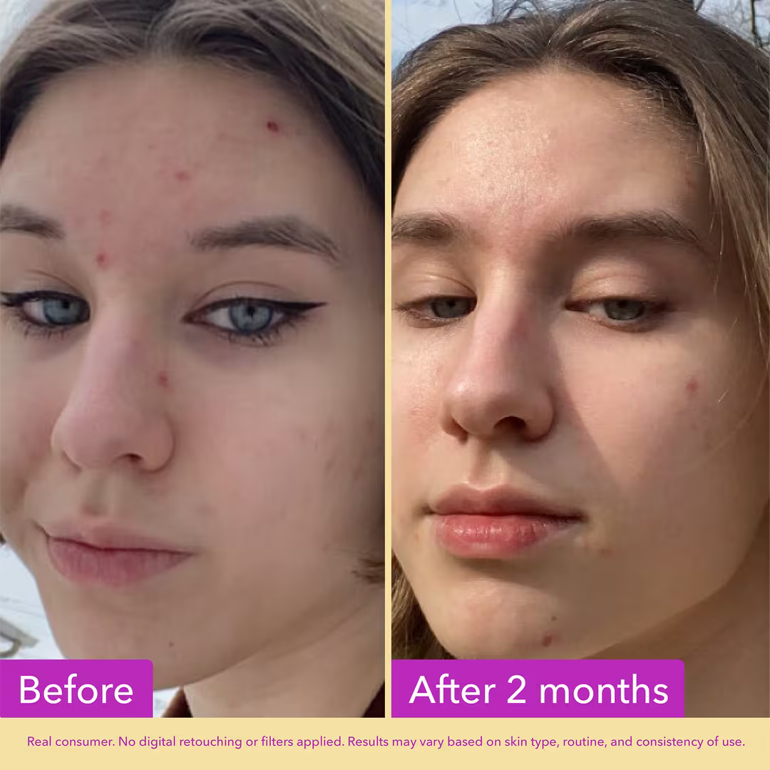 Niacinamide Serum