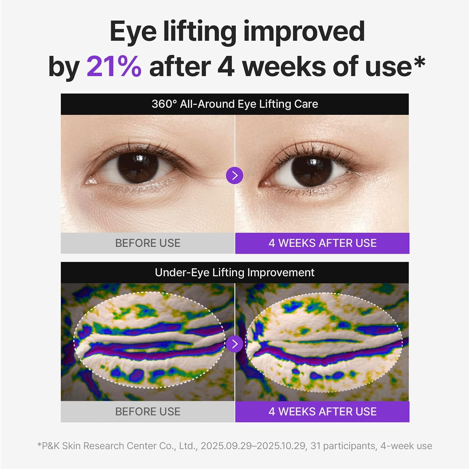 360 Shot PDRN Lifting Eye cream 30ml