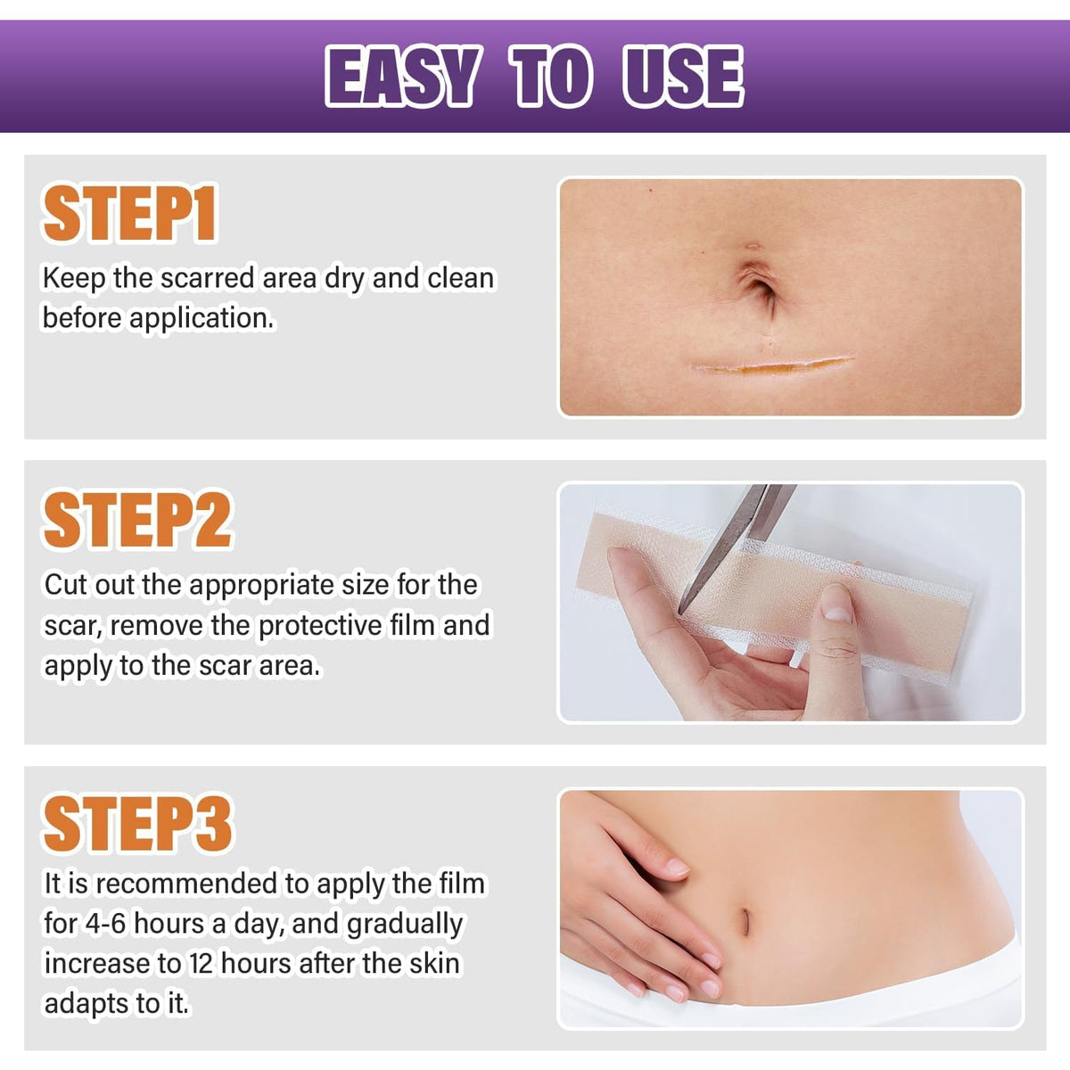Cómo usar PSECICI Silicone Scar Sheets sobre cicatrices cerradas