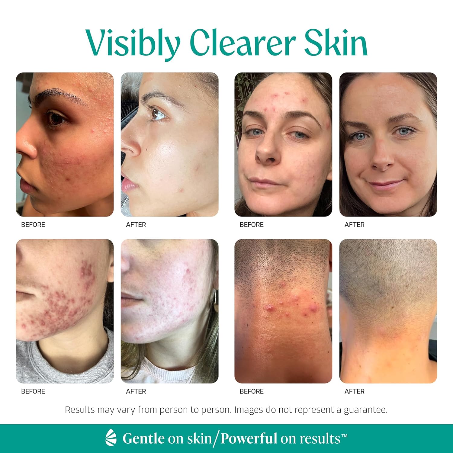Level 1 - 10% Mandelic Acid Exfoliating Serum