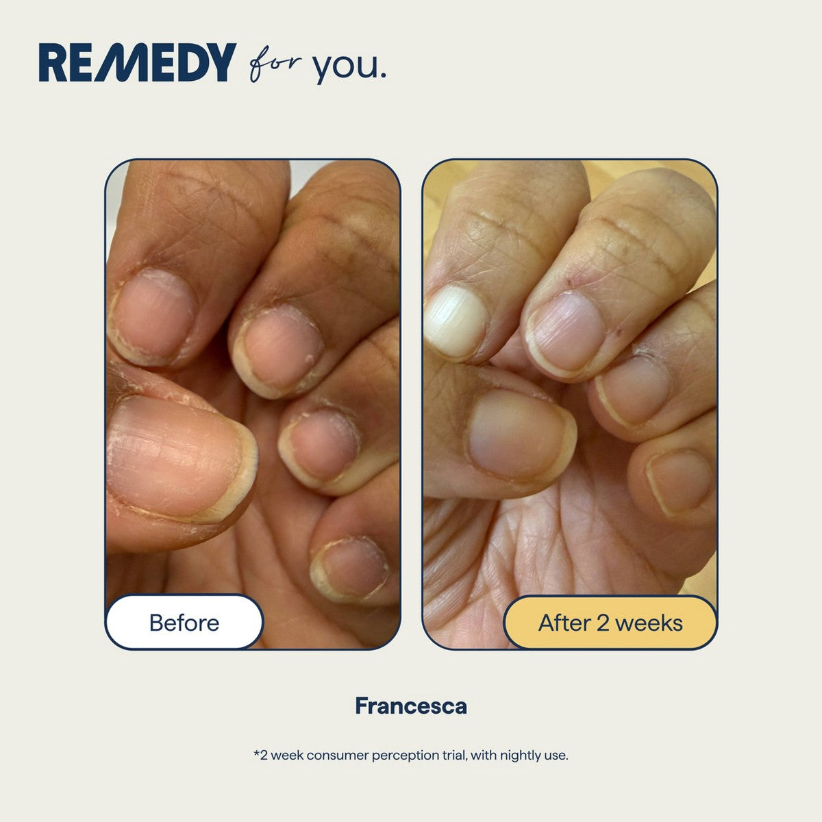 Textura batida de Remedy Skin Hand & Cuticle Firming Cream para manos secas