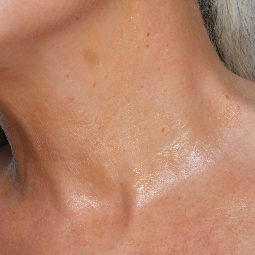 Neck Elasticity Catalyst NEC