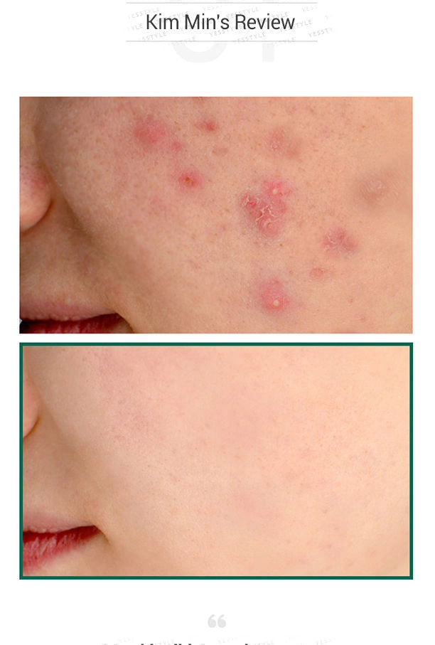 AHA-BHA-PHA 30 Days Miracle Serum