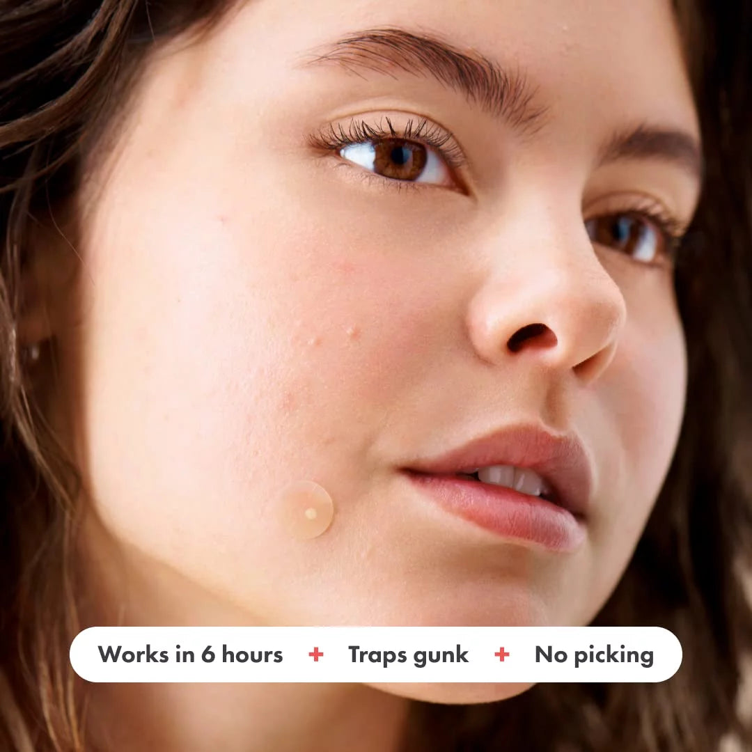 Mighty Patch Acne Pimple Patch Treatment