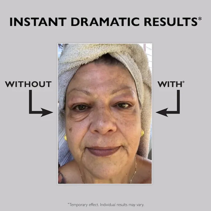Instant FIRMx Eye Temporary Eye Tightener