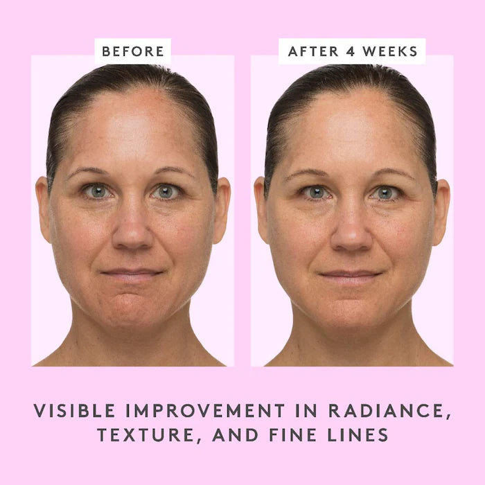 T.L.C. Sukari Babyfacial™ AHA + BHA Mask