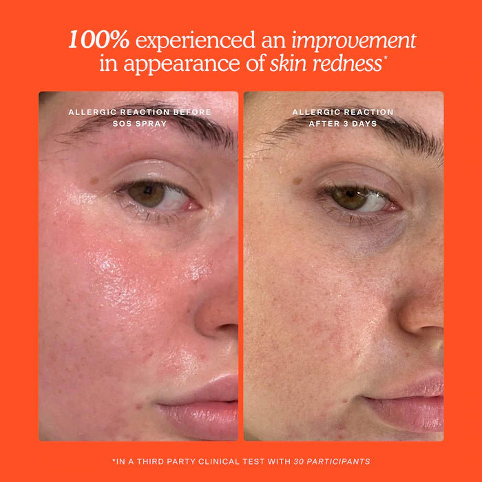 Mini SOS Skincare Bestsellers Set